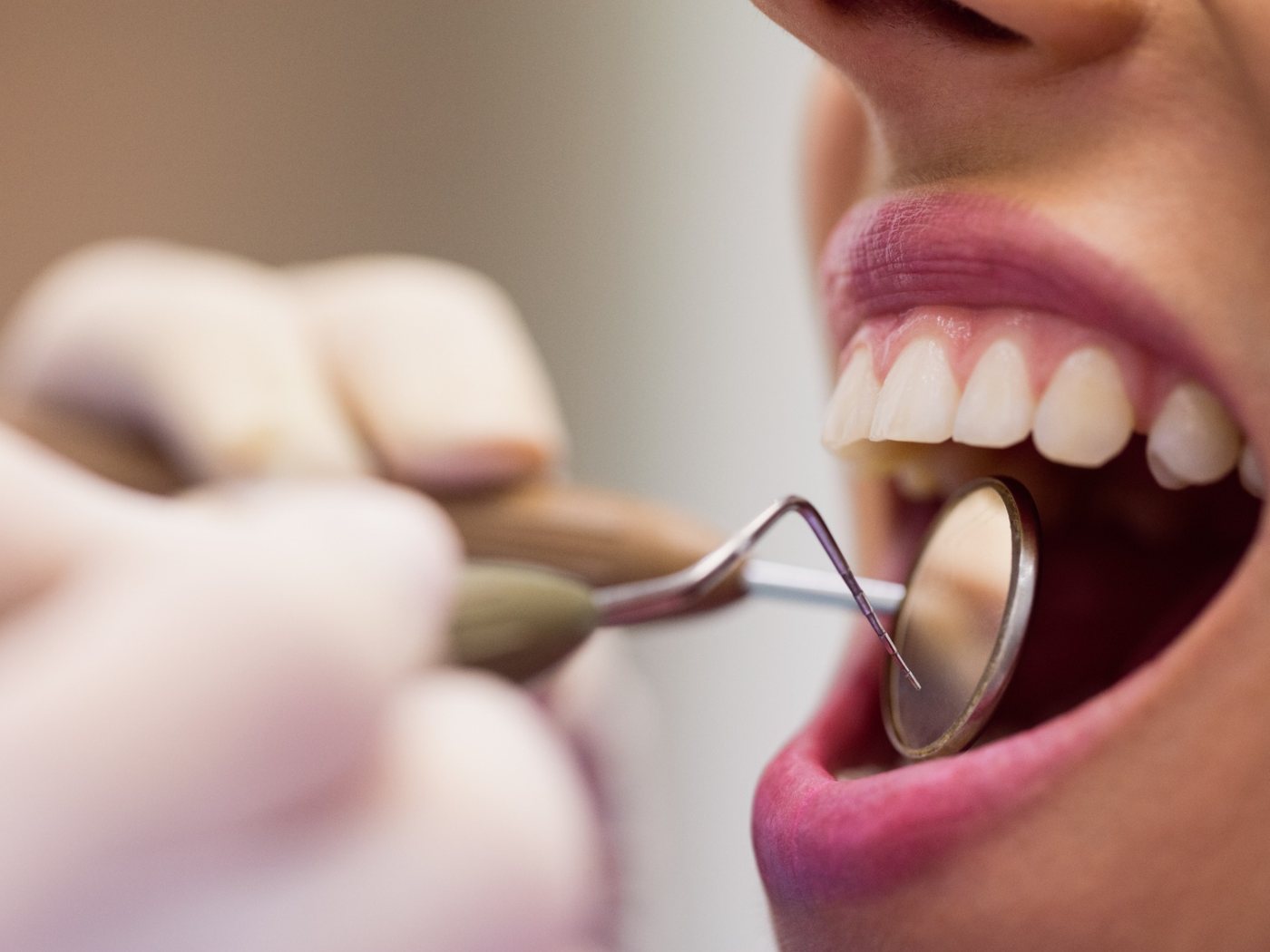 Controllo odontoiatrico professionale