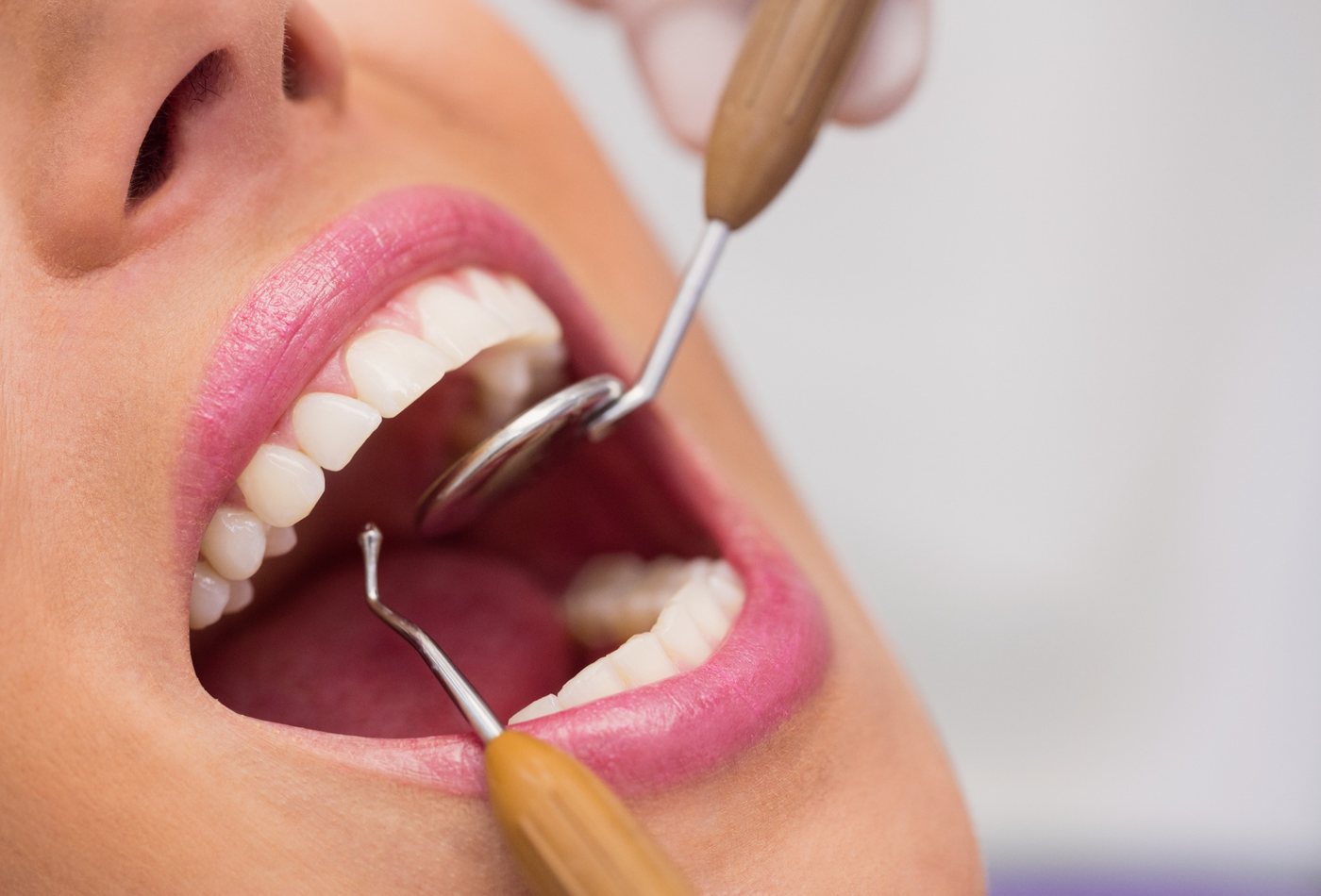 Parodontologia - Studio Dentistico Ferrara