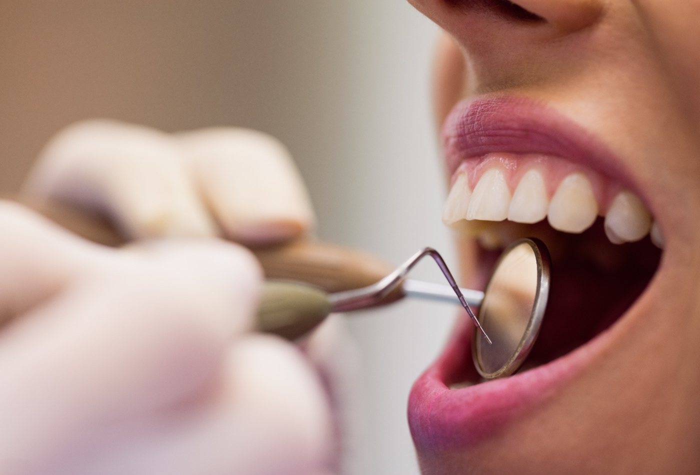 Odontoiatria Restaurativa - Studio Dentistico Ferrara