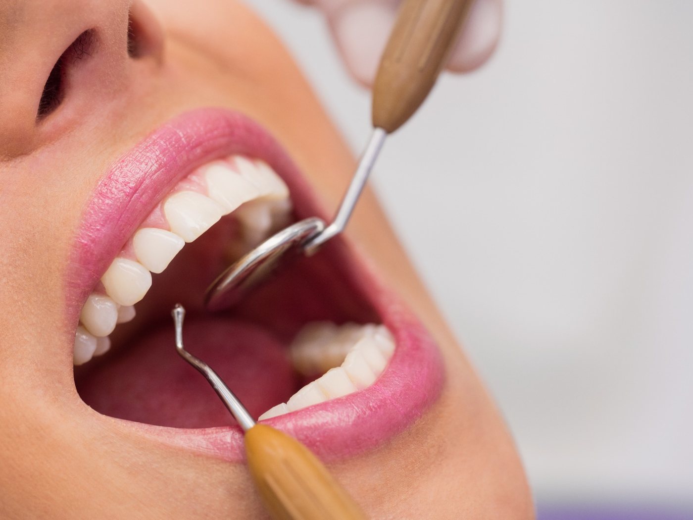 Controllo dentale con strumenti professionali